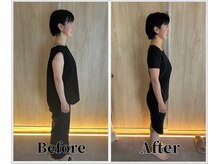 整体ラルース 中目黒(LALUZ)/40代　女性　猫背、巻き肩改善