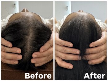 アンドブレインビューティー(and.Brain Beauty)/脳美容ドライヘッドスパ