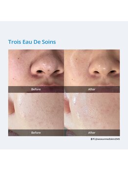 ビューティフルワールド0617(Beautiful World 0617)/TROIS EAU DE SOINS H2O TREATME