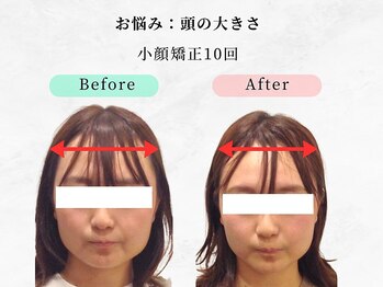 美容整体ウェリナ あま甚目寺院/小顔矯正/骨盤矯正/美脚サロン