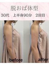 リラ(Lilas)/【痩身】分厚い二の腕