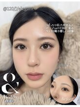 アレーヌ 心斎橋堀江店(Allene)/マツエク/&healthy/LED/マツパ