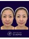 サロン ド ナース ユー ソナ(salon de nurse U.sona)の写真/エステは効果がない。本格美容は怖い。看護師だから取り扱い可能な最高品質マシンで、お顔悩みを速攻解決！