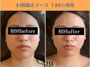 キュープ 表参道店(Qpu)/結果が出るから続けられる!