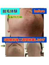 ソレイユ デ オッペン(Soleil De OPPEN)/男性の髭がここまで！？