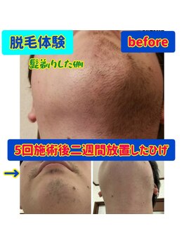 ソレイユ デ オッペン(Soleil De OPPEN)/男性の髭がここまで!?