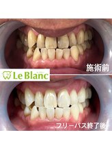 ルブラン 奈良店(Le Blanc)/【50代男性のお客様】