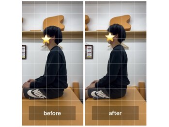 ナオル整体 飯田橋院(NAORU整体)/Before After/飯田橋/整体・矯正