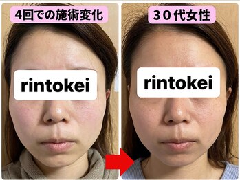 凛と慶/ビフォーアフター