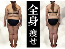 ルーミー(LUME.)の雰囲気（　【全身痩身】高性能マシンでスッキリ全身痩せ）