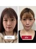 【満足度◎】たるみ改善×姿勢×全身矯正｜90分￥13,980