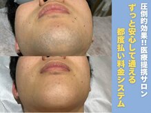 ハナココプラス 水戸店(hanaCoco+Plus)