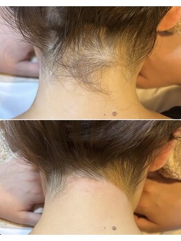 サロン エデンプラス(salon eden PLUS)/うなじワックス