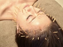 ドリームスタイル 川崎駅前(Dream Style)の雰囲気（美容鍼でお顔の左右差改善・リフトアップ・小顔・ハリツヤUP♪）