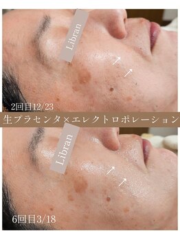 リブラン(Libran)/しわに内側からアプローチ★