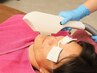 【男性】頬や首回りの毛も追加料金なし◎ヒゲ脱毛お試し2回セット
