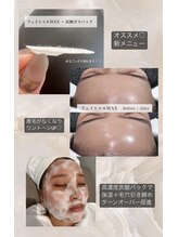 ジラソル(girasol)/フェイシャルWAX + 炭酸パック