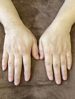 カミーユ(Camille)/ハンドパワーでヒーリング