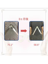 和ぎ整体院/肋骨矯正で改善