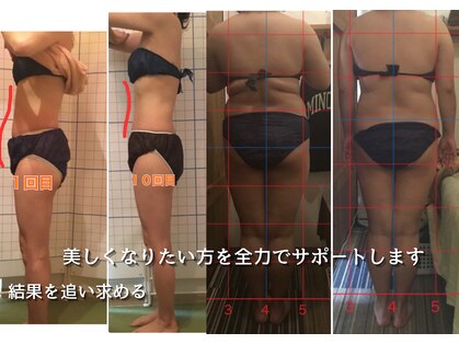 おもろまちエステサロン 新都心店の写真