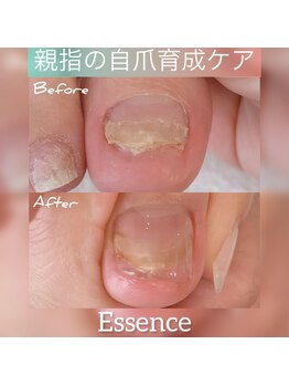 エッセンス (Essence)/フット自爪育成(親指) ￥3,980～