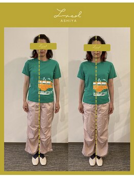 ルク ソル(Luxsol)/食いしばり 姿勢を変えると激変