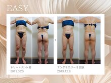 イージー(EASY)/