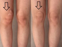 ピエモワ 渋谷(PiEmoi)/O脚X脚のお悩みにも！