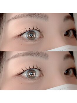 ダズル(DAZZLE)/ラッシュリフト（マツパ）