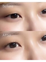 エデリー(Edely)/