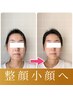 黄金比率の美顔に!【顔の歪み・左右差】小顔矯正×全身整体90分¥22,000→