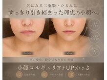 プール エドボリ(POOL EDOBORI)