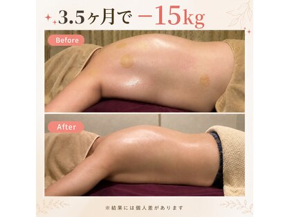 アユスリム(AYU SLIM)の写真