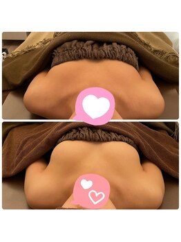 ビジョイ(Bejoy)/美アップバスト