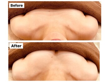 アンシャンテ(ENCHANTER)/光バストアップ