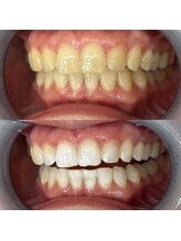 ライトビューティー 池袋店(LightBeauty)/症例写真