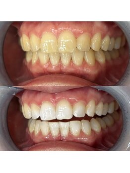 ライトビューティー 池袋店(LightBeauty)/症例写真