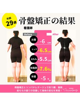 セレンディピティ 刈谷店(Serendipity)/【美容骨盤矯正】痩身ダイエット
