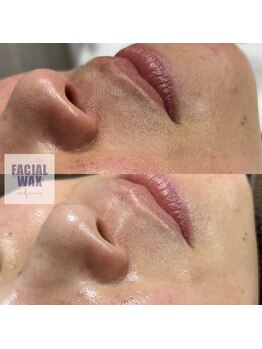 プアメリア(Pua Melia)/マリムーブフェイシャルワックス