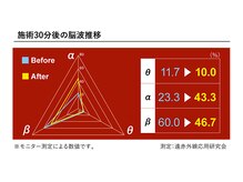 サロン 和/α波増加で高いリラックス効果も
