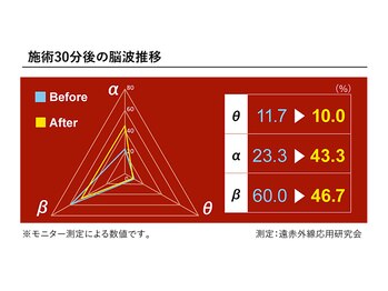 サロン 和/α波増加で高いリラックス効果も