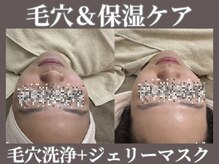 マヴィ 高槻店(MavY.)/毛穴保湿