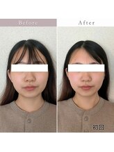 エスプリクレール(Esprit Clair)/【札幌】頭蓋骨小顔セラピー