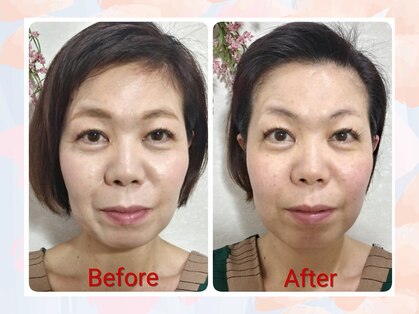 ヴィーナススック(Venus SSOOK)の写真