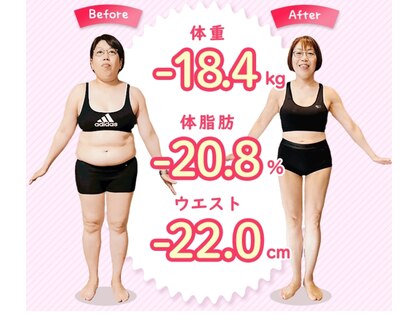 脱毛 アンド メイクボディ かんばやしの写真