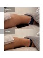 ルネアススパ 南青山(Lune’as Spa) WINBACK Winback/ウィンバック/痩身/ダイエット/くびれ/内臓ケア