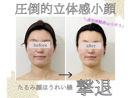 コモレビ(Komorebi)の写真