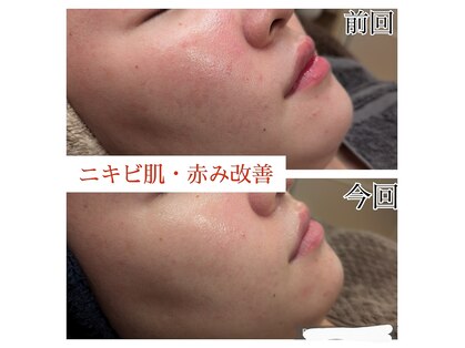 ウィズユー(with U)の写真