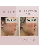 スリール 吉祥寺店(Sourire)/小顔