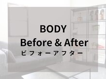 リライブ 亀有店(Re:Lives)/痩身ダイエットのBefore&After♪